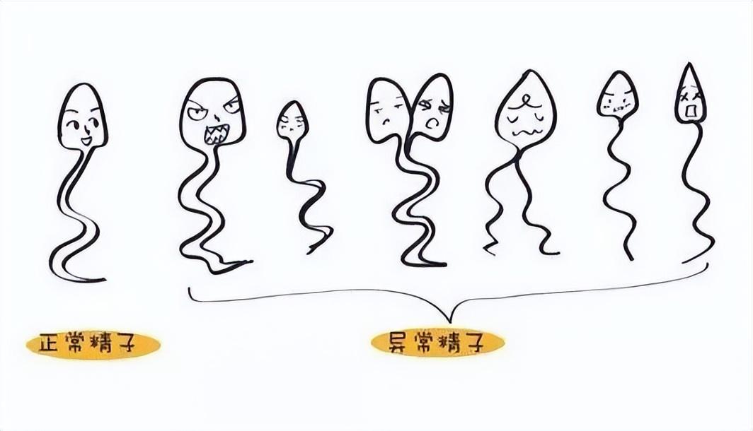 全球男性精子量告急且质量很差.小蝌蚪变得少弱病残的原因