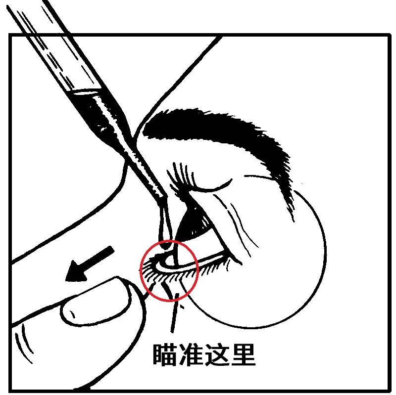 专说眼药水不要直接滴到眼球上,如何滴眼药水才是正确的?