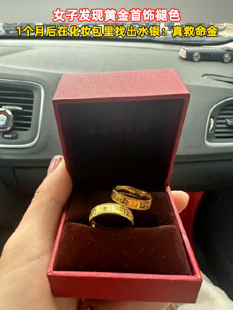女子发现佩戴的金戒指褪色,竟救自己一命,这真的救命金呀