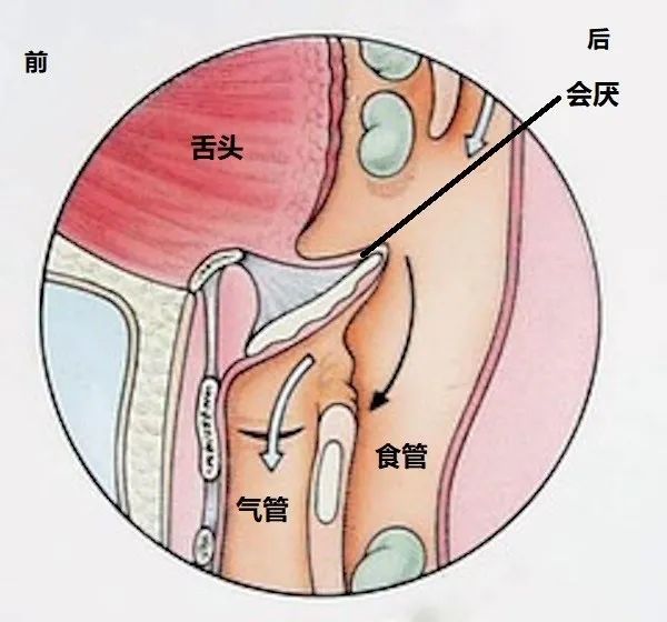 一旦出现这个姿势要立即就医.大人小孩都要警惕急性会厌炎